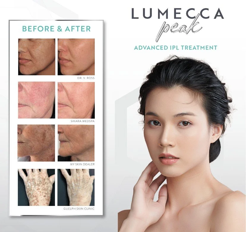 Medspa in Colorado Springs, CO, 80922 | IPL Near Me