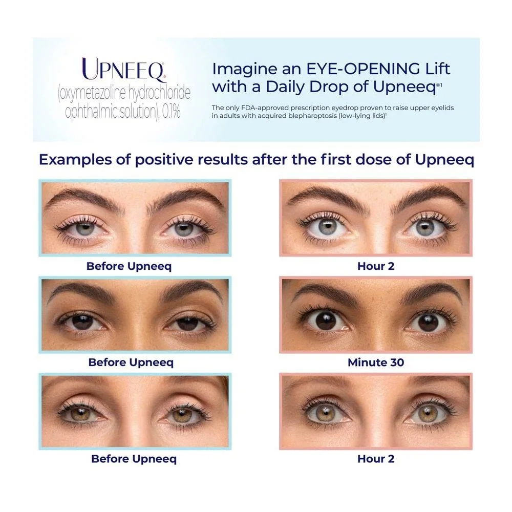 UPNEEQ® (Oxymetazoline Ophthalmic Solution 0.1%)