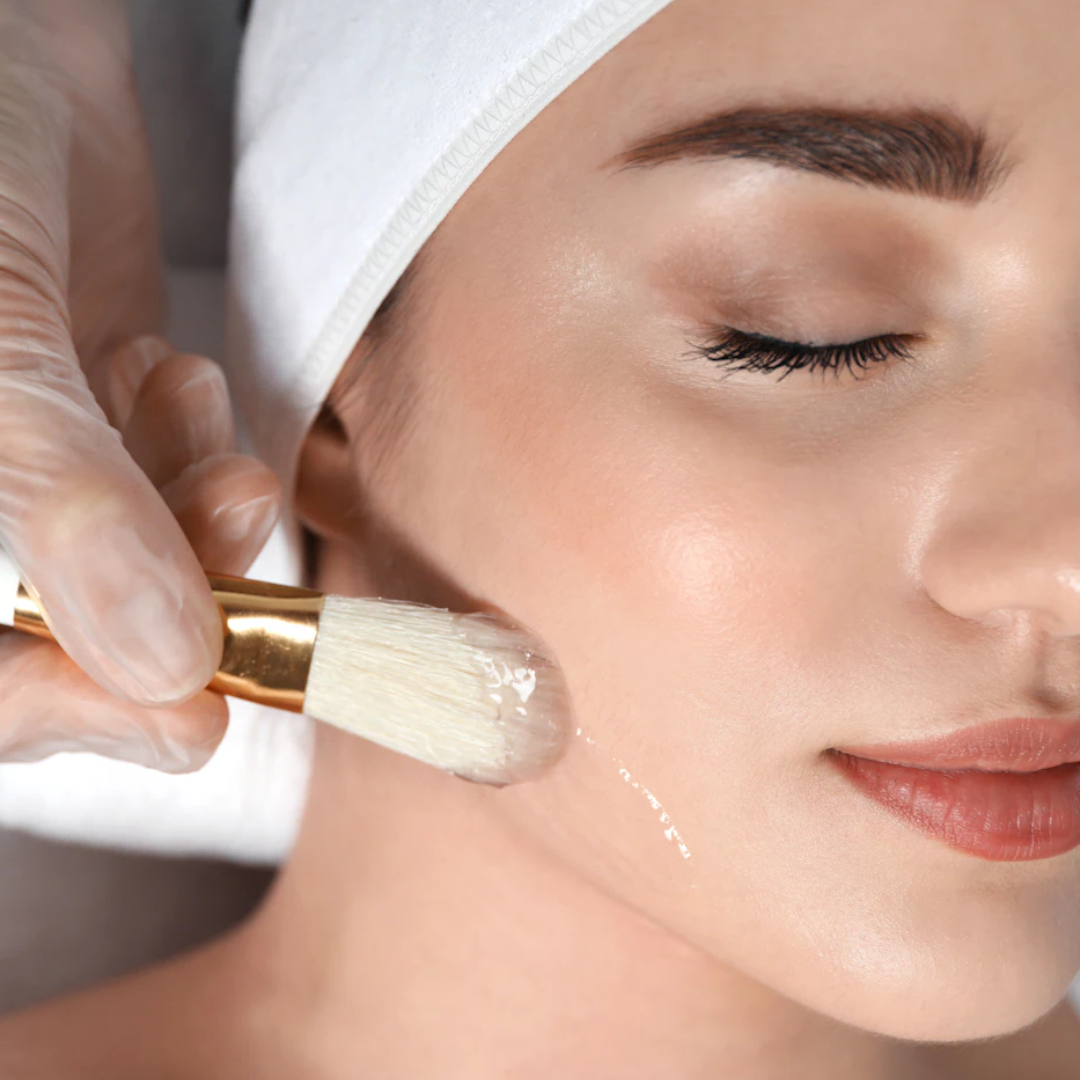 Medspa in Plymouth, MI, 48170 | Chemical Peels Near Me