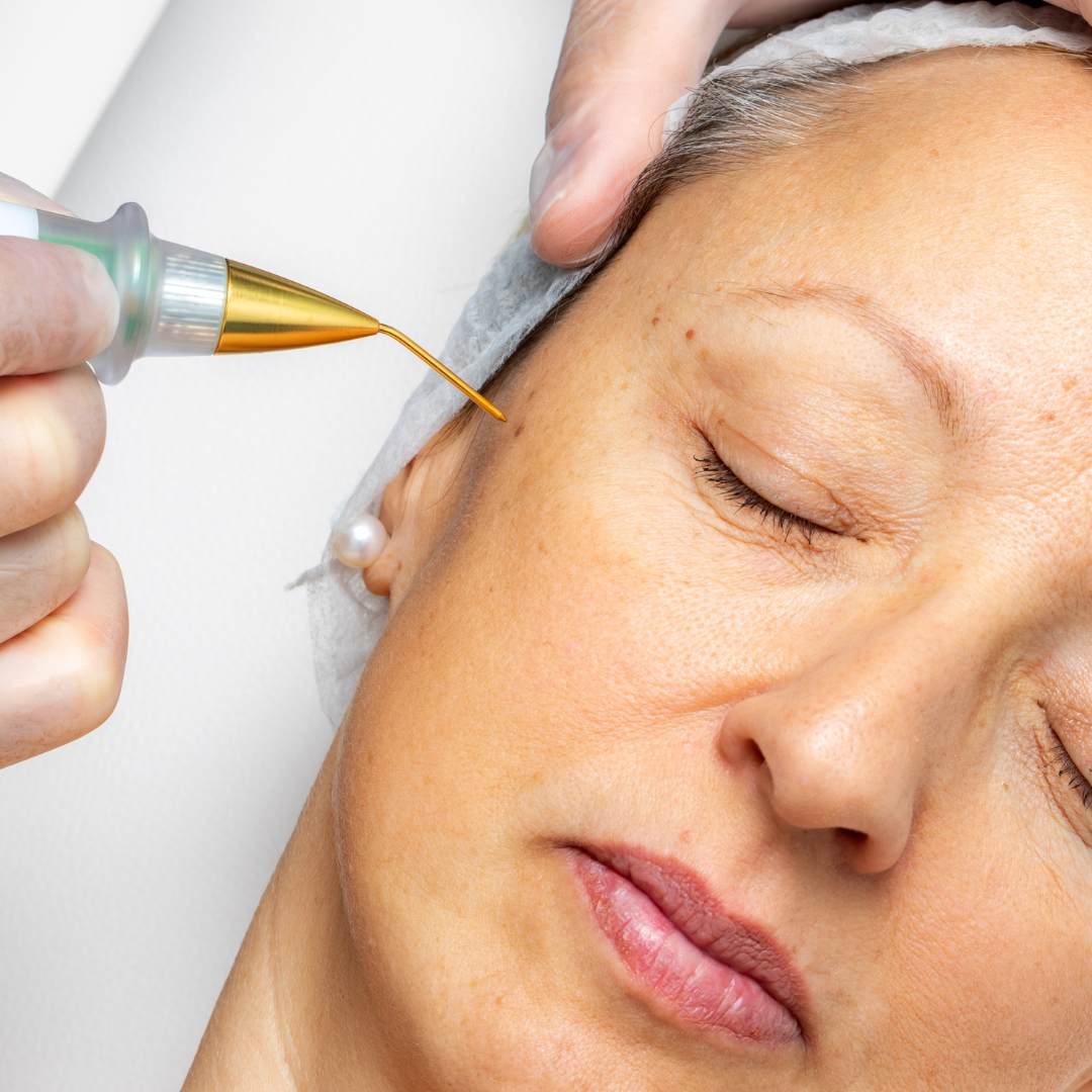 Medspa in Plymouth, MI, 48170 | Plasma Pen Near Me