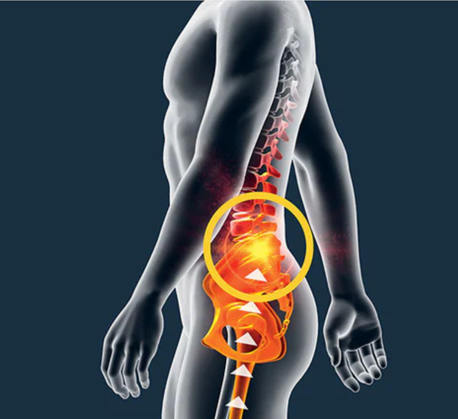Spine and lower back pain associated with improper gait and foot support