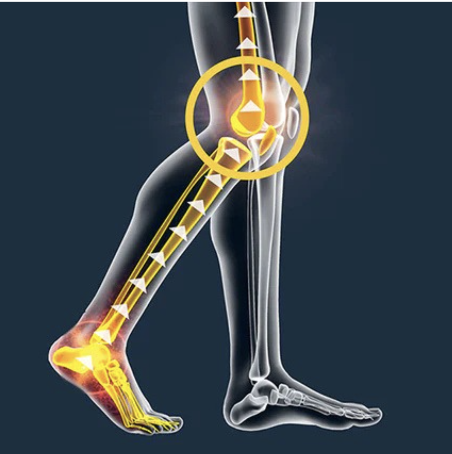 Knee joint pain linked to poor foot alignment and biomechanical imbalance