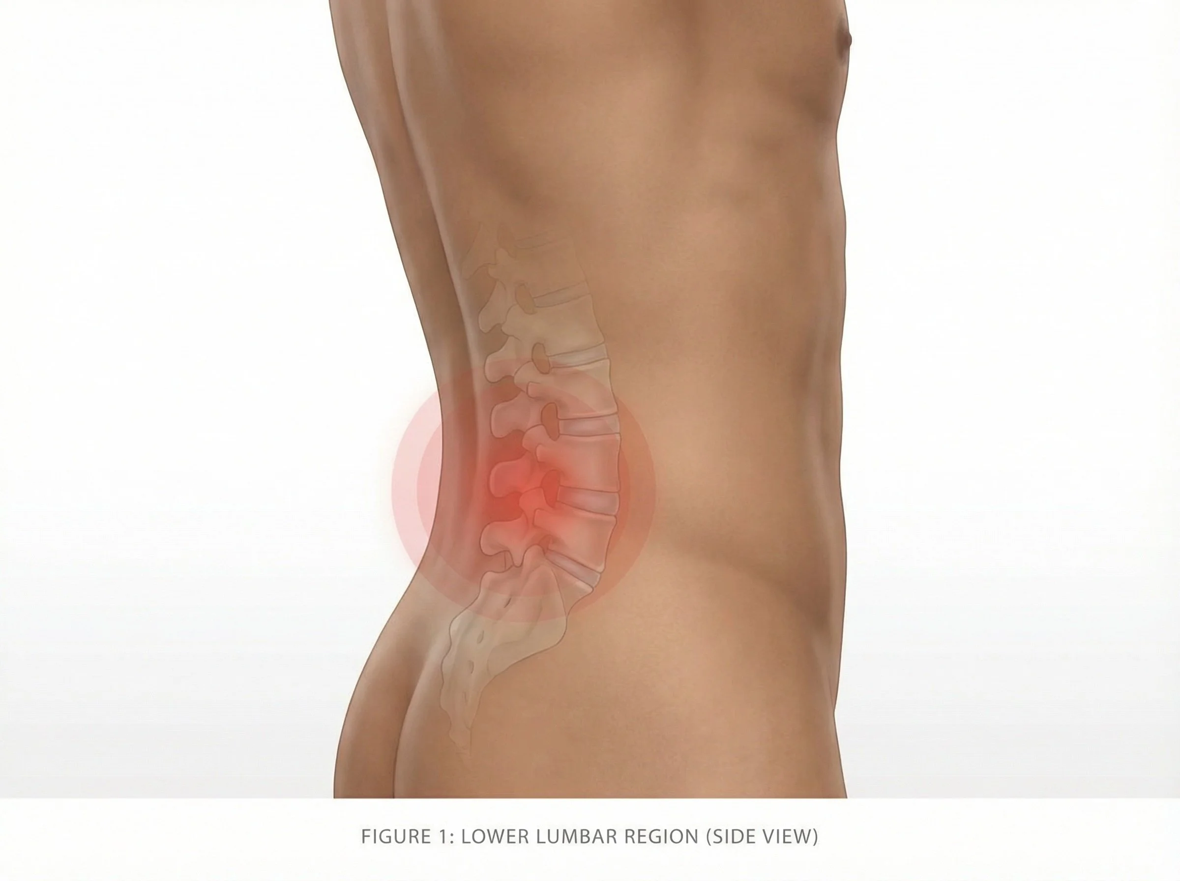 Lower back pain linked to poor foot alignment and posture imbalance