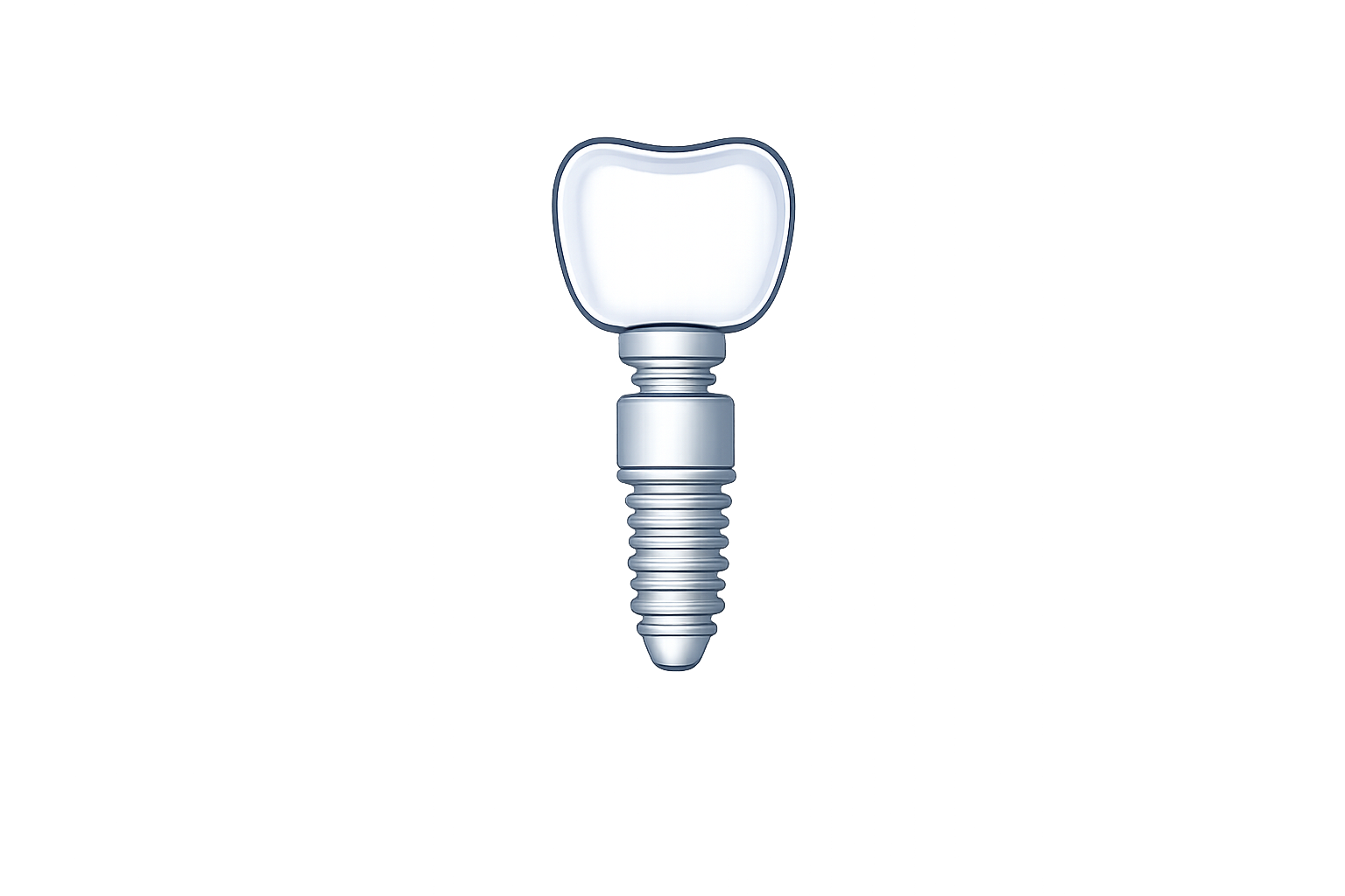 Grafische Darstellung eines Implantats mit Gewinde. Das Bild ist digital bearbeitet und zeigt eine Nahaufnahme des Metallteils.