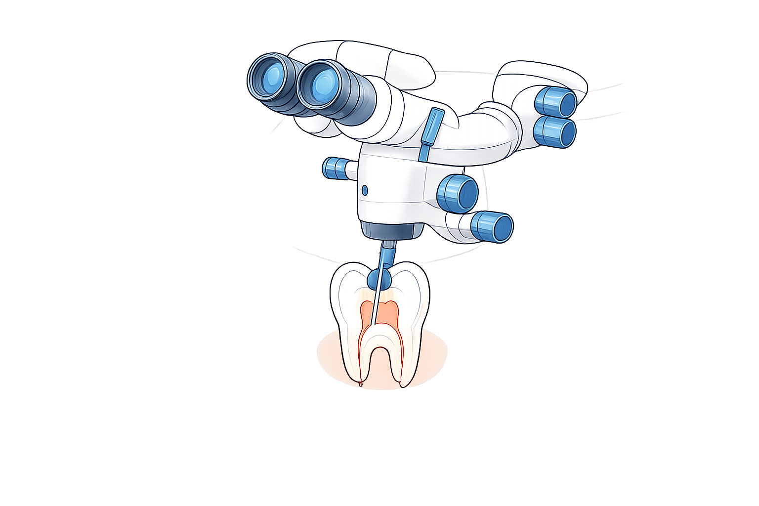 Illustration eines zahnärztlichen Roboters, der eine Zahnbehandlung an einem menschlichen Zahn durchführt.