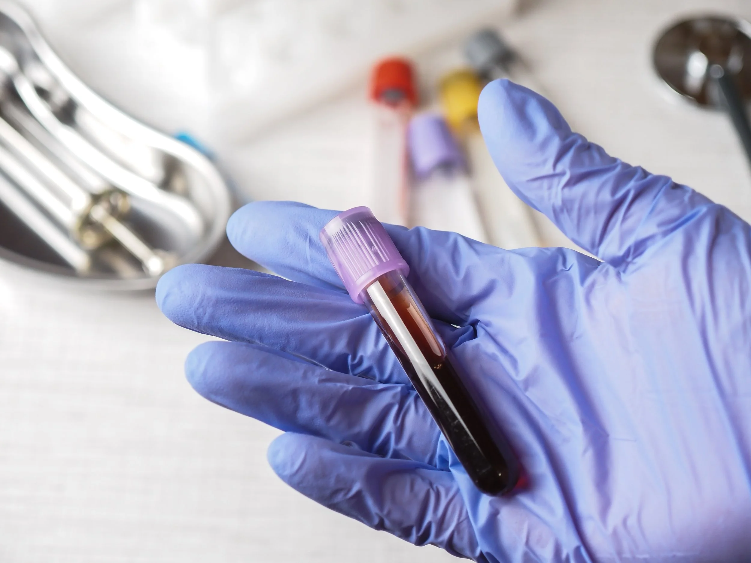 Lab in Spartanburg SC