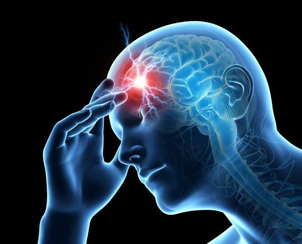 How Cranial Adjustments Can Help Migraines: A Chiropractor's Guide to Natural Migraine Relief