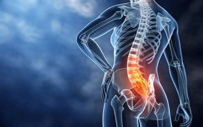 How Can a Chiropractor Help With My Sciatica? A SOT Chiropractor's Answer