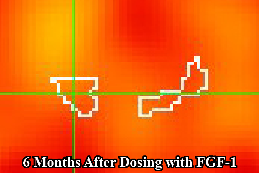 A heatmap with orange and red colors showing two pixelated mouse-like shapes outlined in white, with green axes. Text at the bottom reads "6 Months After Dosing with FGF-1."