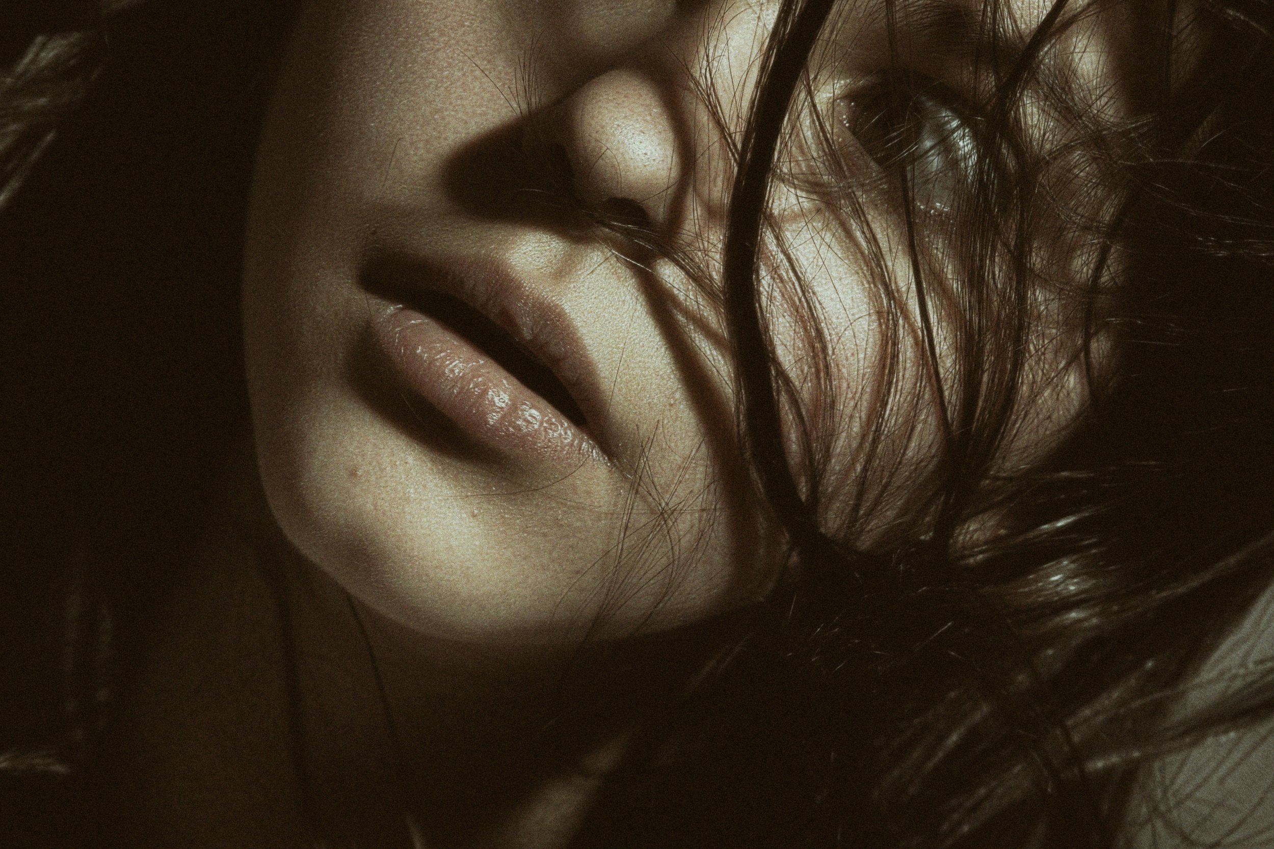 Accutane vs Natural Acne Treatment: Understanding Your Options