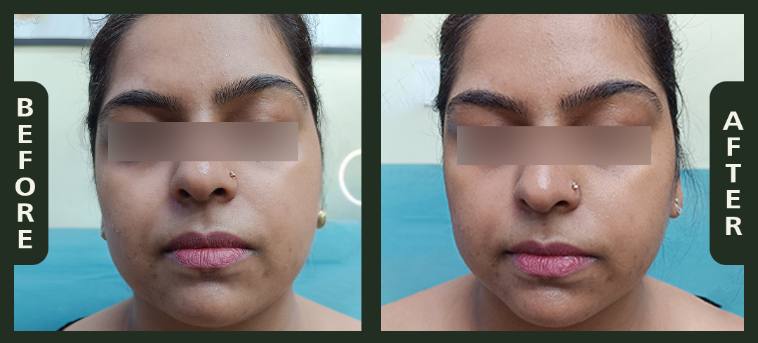 korean+facial.png