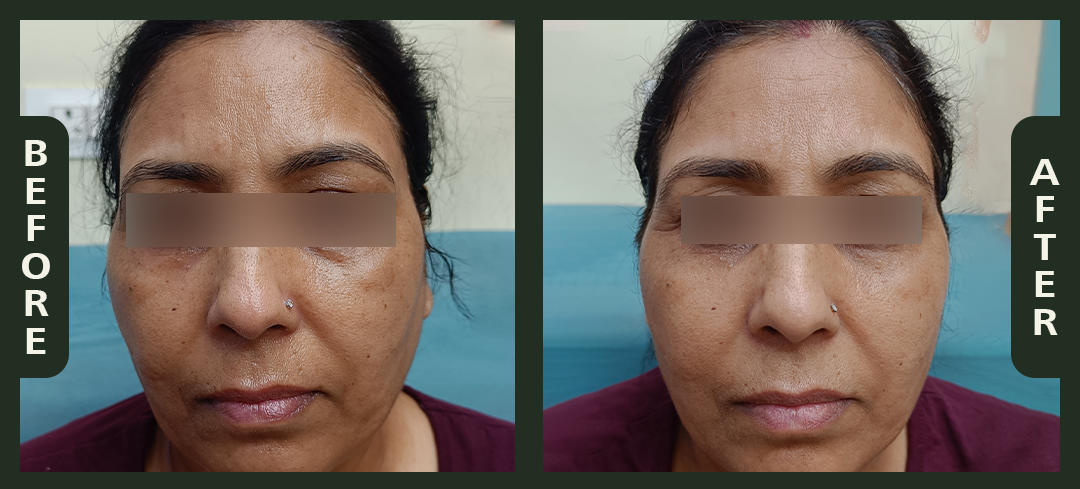 korean+facial.png