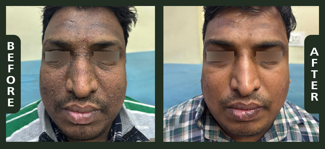Ram+Lakhan+1.png