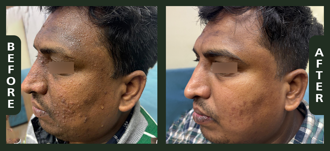 Ram+Lakhan+3.png