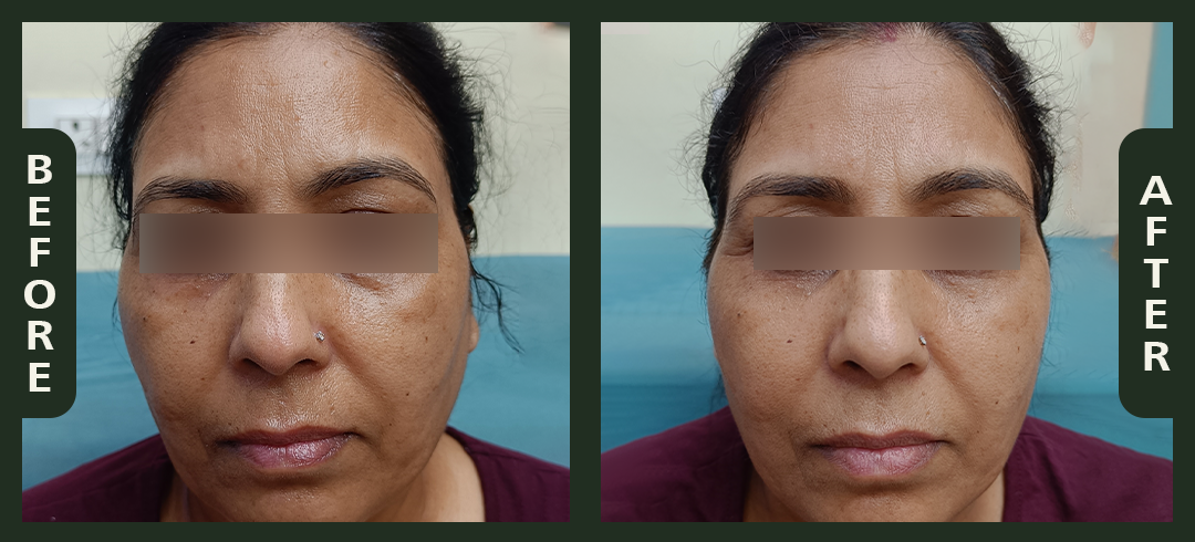 korean+facial.png
