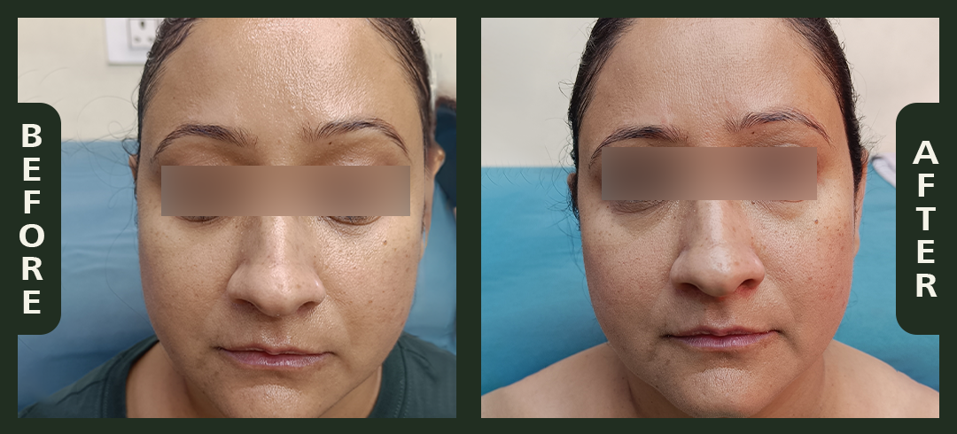 korean+glass+facial+2.png