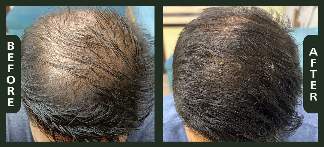 hair+1.1.png