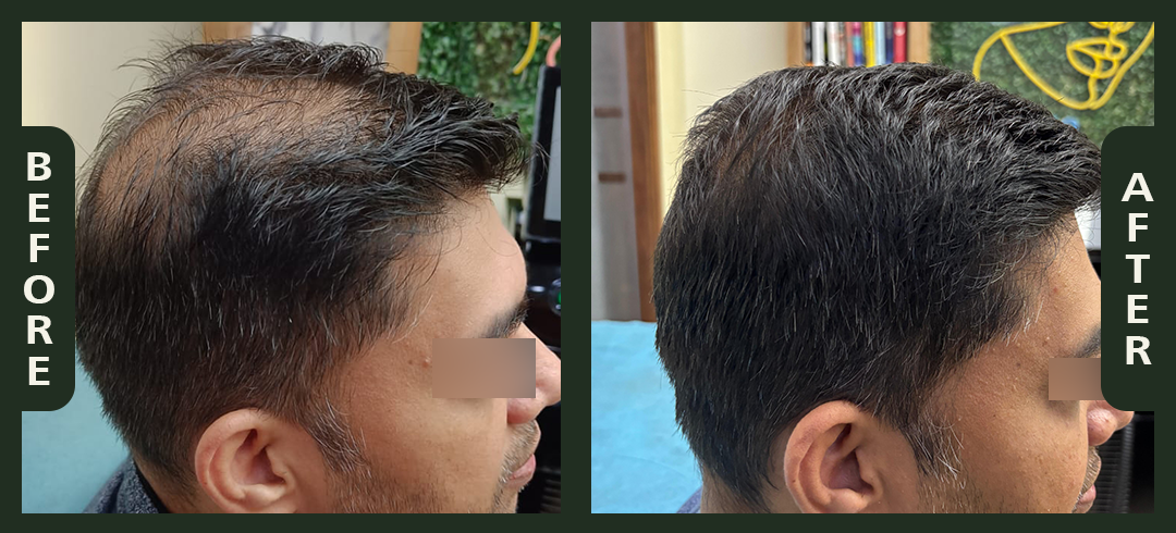 hair+1.2.png
