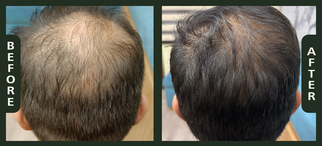hair+1.3.png