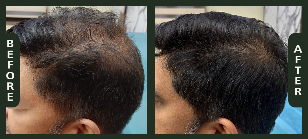 hair+1.4.png