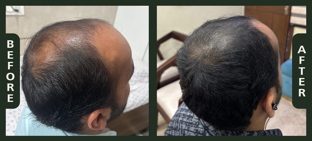 hair+2.1.png