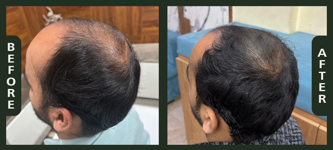 hair+2.2.png