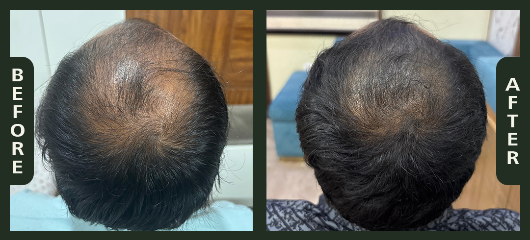 hair+2.3.png