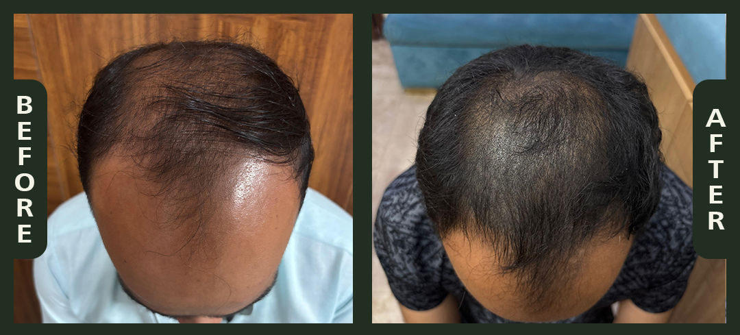 hair+2.4.png
