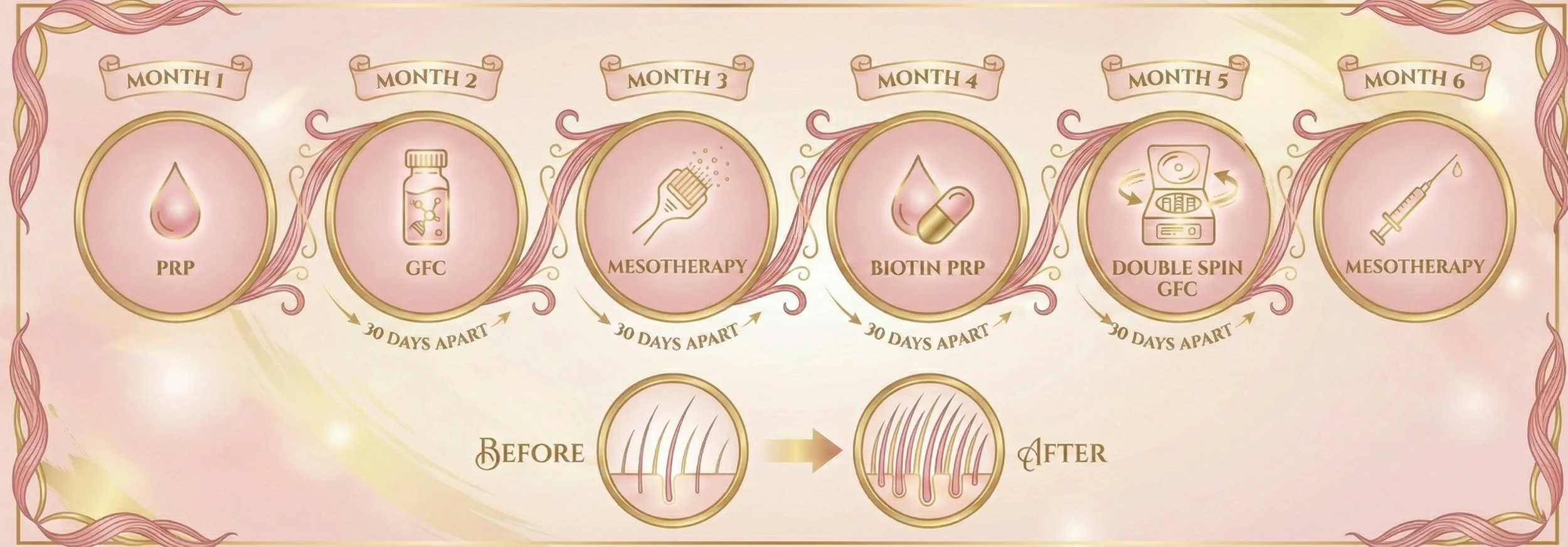 A timeline graphic showing six steps for a hair treatment process, each associated with a month and a specific therapy: PRP, GFC, Mesotherapy, Biotin PRP, Double Spin GFC, and Mesotherapy, with 30 days between each step. The image also depicts a before and after comparison of hair growth.