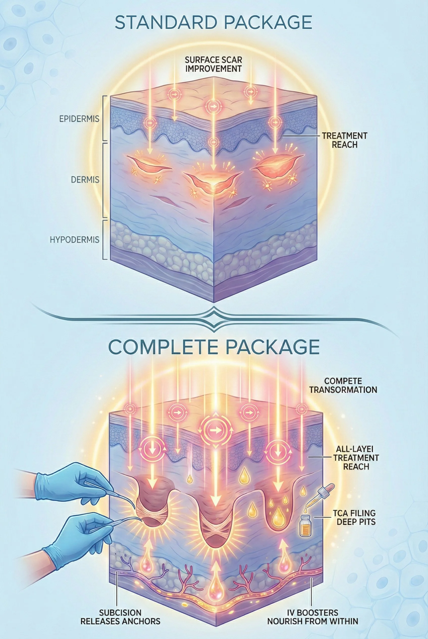 An infographic comparing a standard skin treatment package and a complete package, showing skin layers and steps involved. The top section illustrates the standard package focusing on surface scar improvement within epidermis and dermis layers. The bottom section depicts the complete package with detailed steps like subcision, TCA deep pits, all-layer treatment reach, and IV boosters, with a doctor injecting into skin and arrows indicating processes.