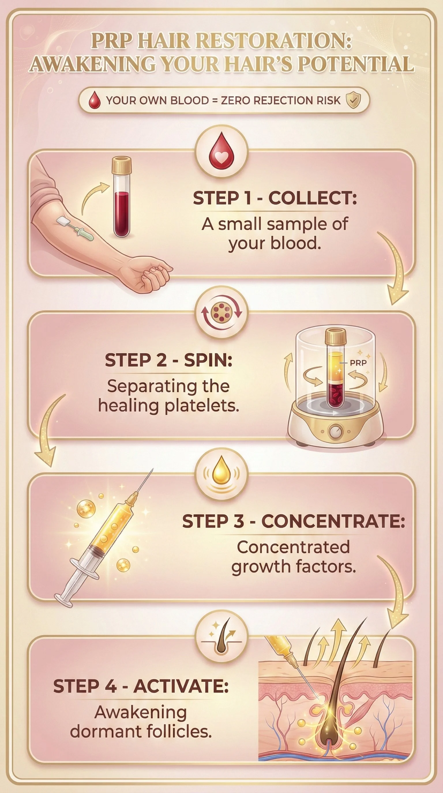 Steps for PRP hair restoration: 1. Collect a small blood sample. 2. Spin to separate healing platelets. 3. Concentrate growth factors. 4. Activate to awaken dormant follicles.