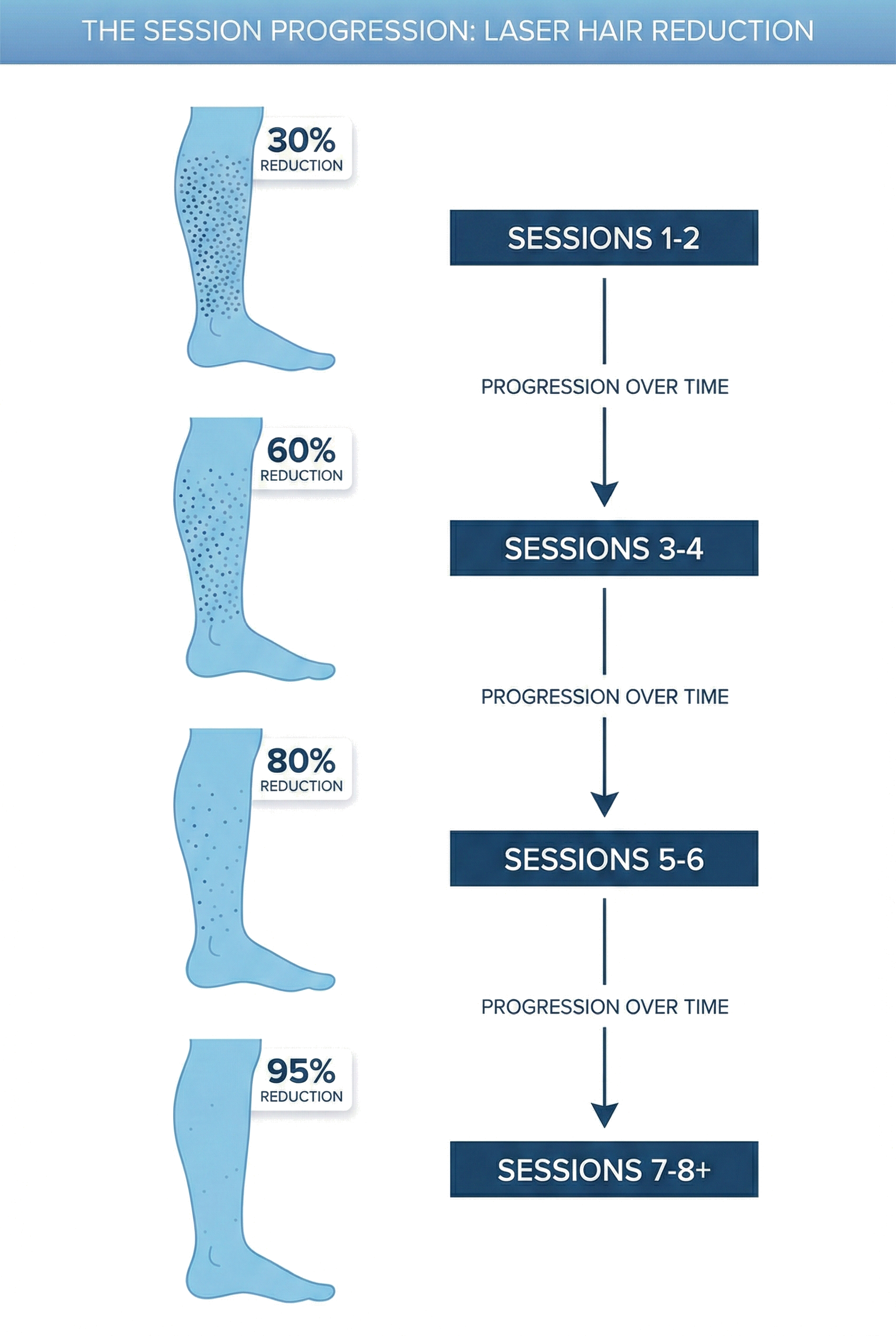 Diagram showing the progression of laser hair reduction sessions, with increasing hair reduction percentages: 30% after 1-2 sessions, 60% after 3-4 sessions, 80% after 5-6 sessions, and 95% after 7 or more sessions.