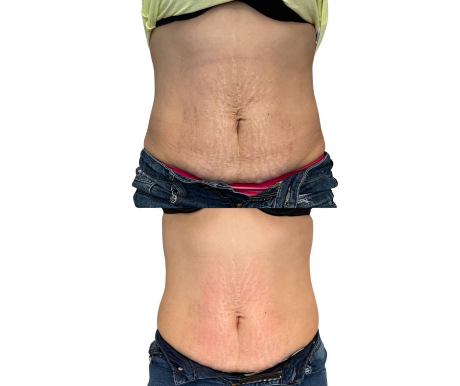 Untitled (Facebook Post).png