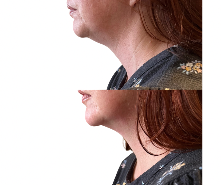 Untitled (Facebook Post).png