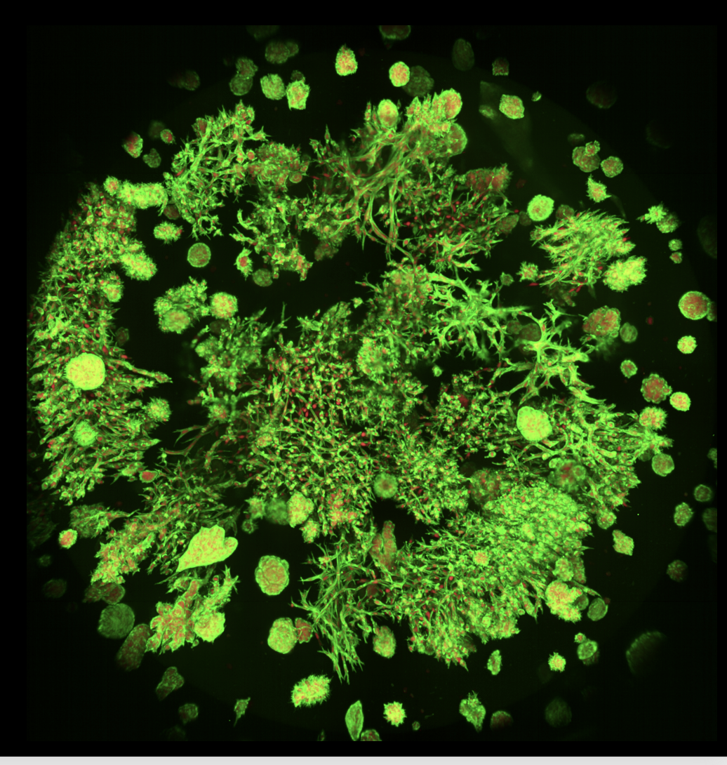 Microscopic view of various green algae and microorganisms illuminated with fluorescent lighting.