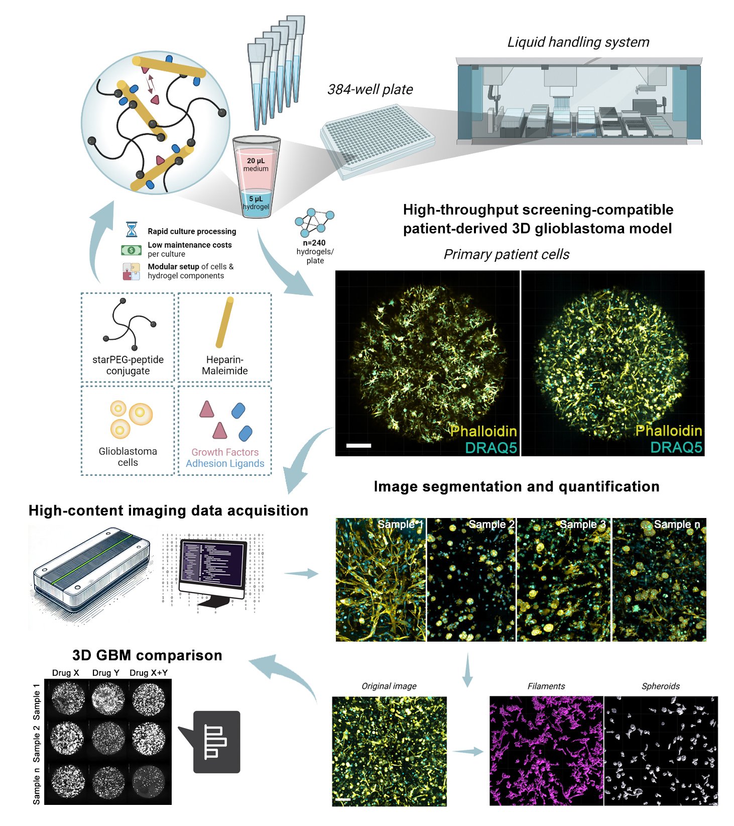 Diagram showing a high-throughput screening system for patient-derived 3D glioblastoma models, including primary patient cells, a liquid handling system, 384-well plates with hydrogel components, and an imaging process for quantification and comparison of drug responses with 3D graphics of sample images and analysis results.
