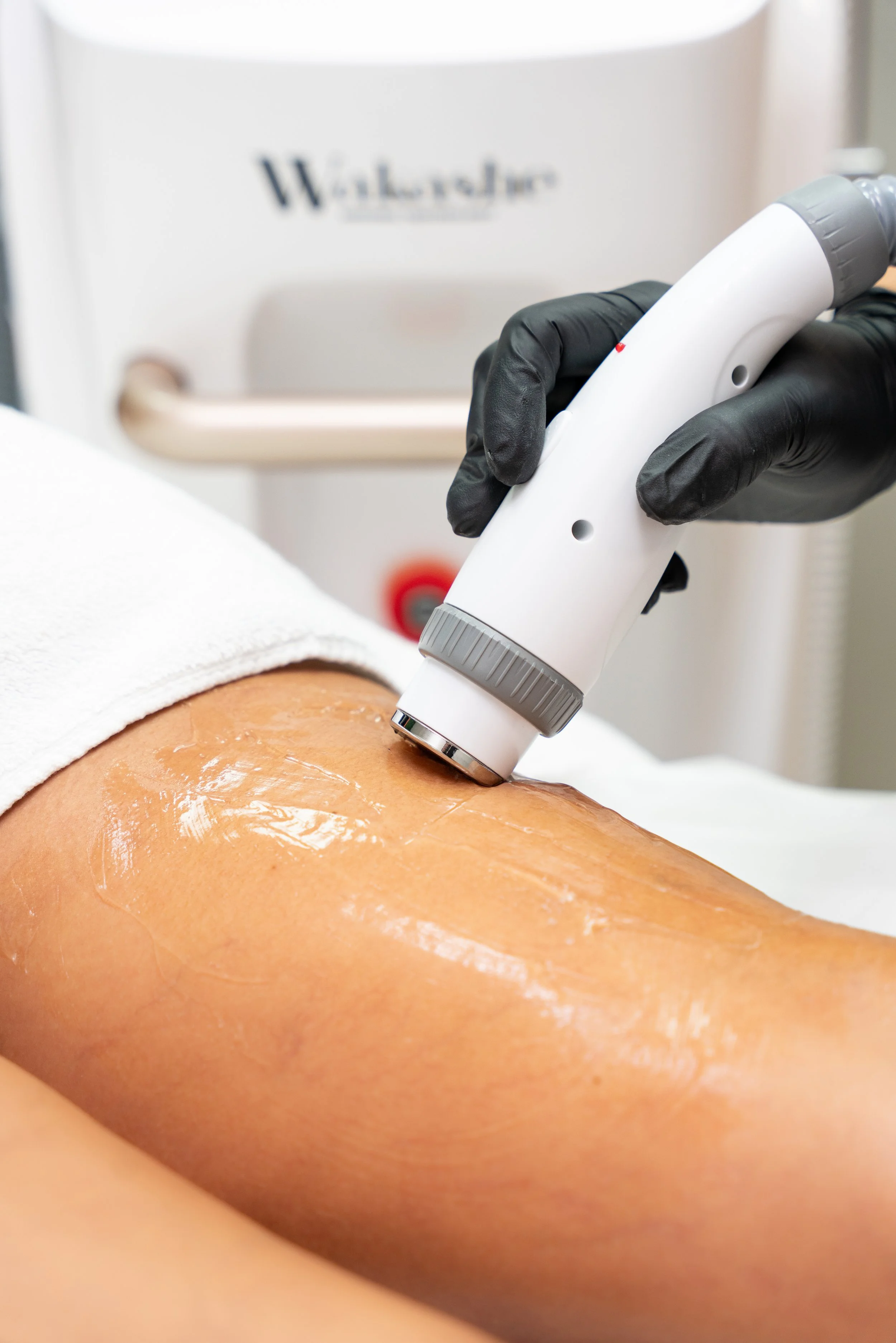 Client receiving Cold RF treatment on the legs, with a technician wearing black gloves operating the handpiece.