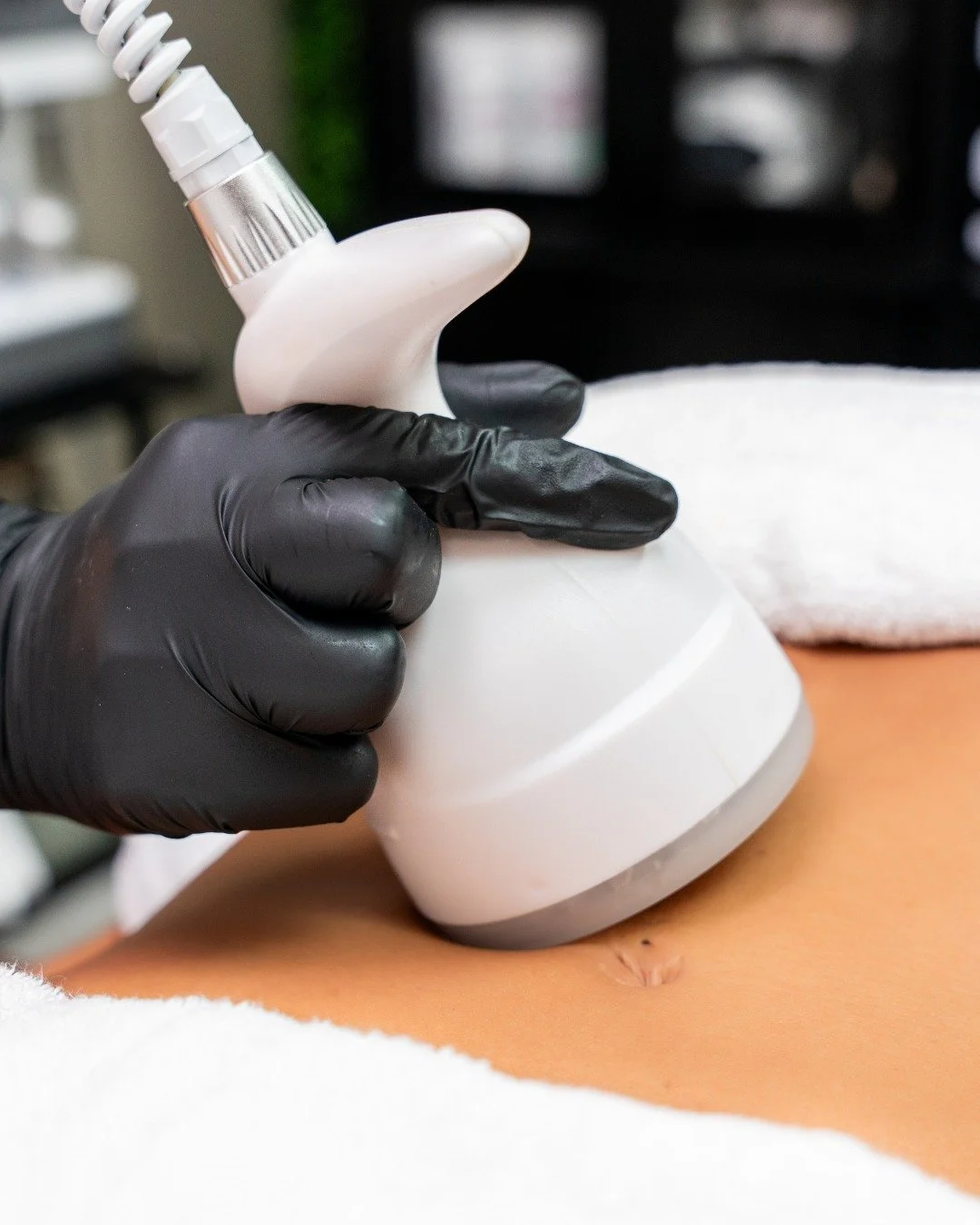 Cryo-Cavitation

Unveil your most sculpted silhouette with a touch of innovation and artful pampering. Our Cryo-Cavitation experience exquisitely refines stubborn curves and enhances natural beauty, blending advanced technology for visible, elegant t