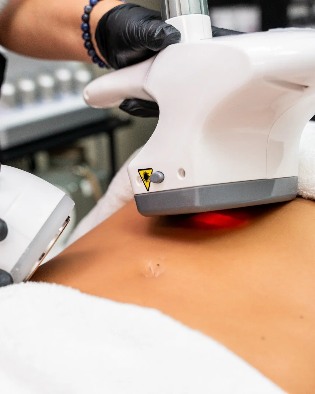 Vela - Cavitation

Reveal your most radiant silhouette. Our signature body experience seamlessly combines innovative 80k Cavitation with VelaShape, delicately refining your contours to unveil true confidence in every curve. For a limited time&mdash;r