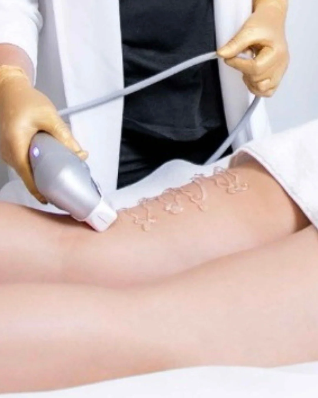 HIFU w/ RF Vacuum

Reveal a new silhouette. Indulge in our signature sculpting ritual that seamlessly marries cutting-edge technology and artistry, unveiling smoother curves and a refined contour. Experience exceptional skin firmness and elegant text