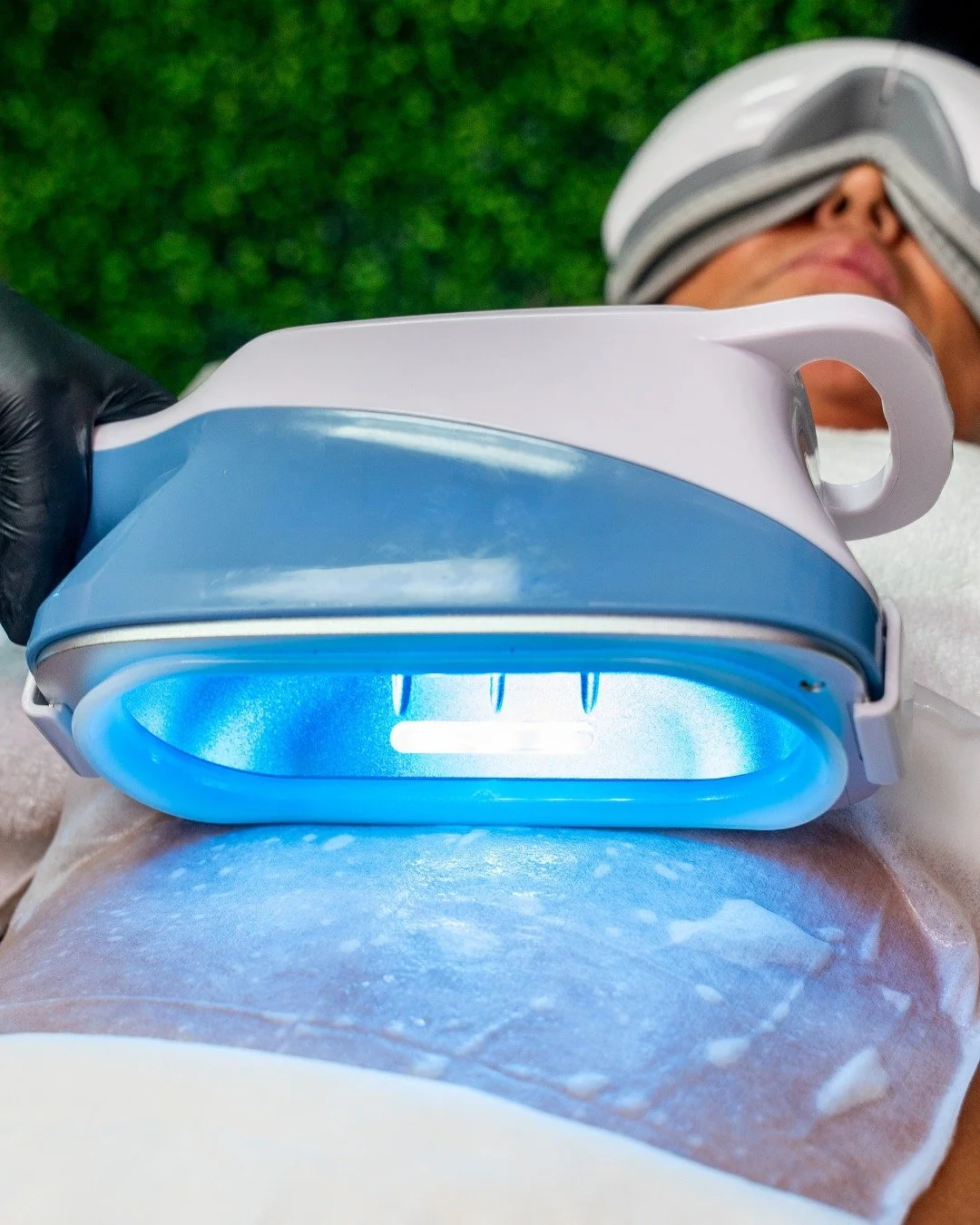 Cryolipo 360

Redefine your contours with an experience as exquisite as your aspirations. Cryolipo 360 offers beautifully sculpted results with no downtime&mdash;just pure, confident transformation. Embrace the art of refinement and let your silhouet