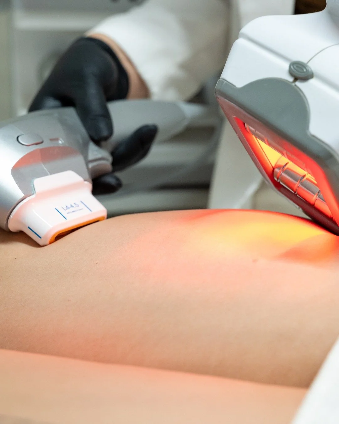 Premium Cellulite Treatment

Reveal the art of smooth, sculpted skin. Let our advanced treatment cocoon you in luxury&mdash;combining modern techniques that gently refine texture, restore firmness, and renew confidence in every curve. For a limited t