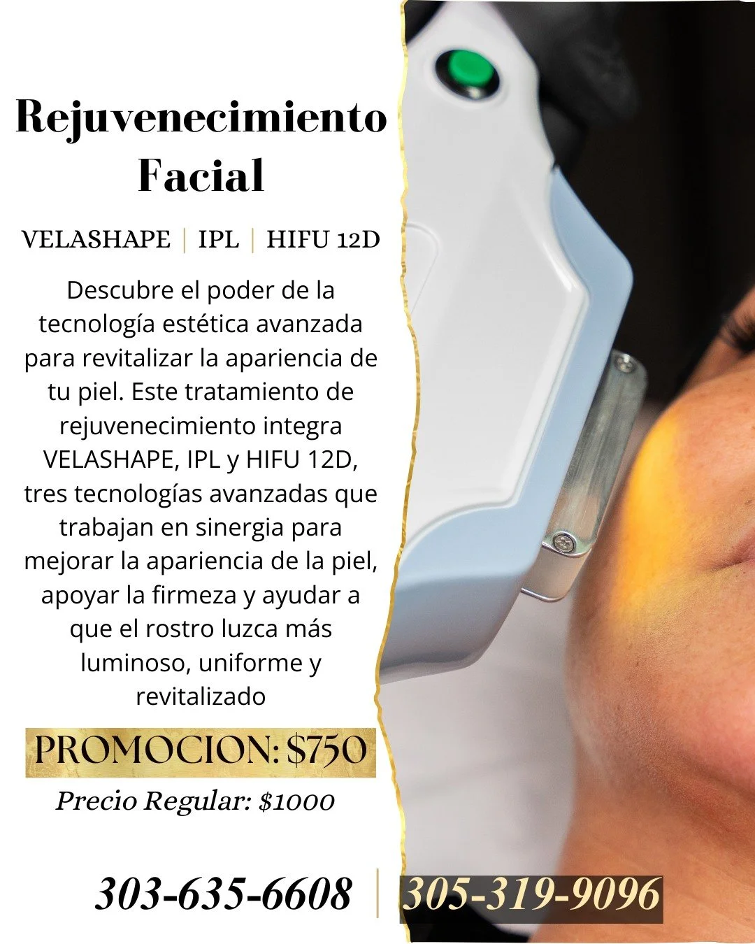 Triple Rejuvenation

Experience the quiet power of renewal. Our Triple Rejuvenation treatment layers advanced technology to unveil smoother texture, glowing radiance, and a naturally lifted look&mdash;without surgery or downtime. Enjoy a more luminou