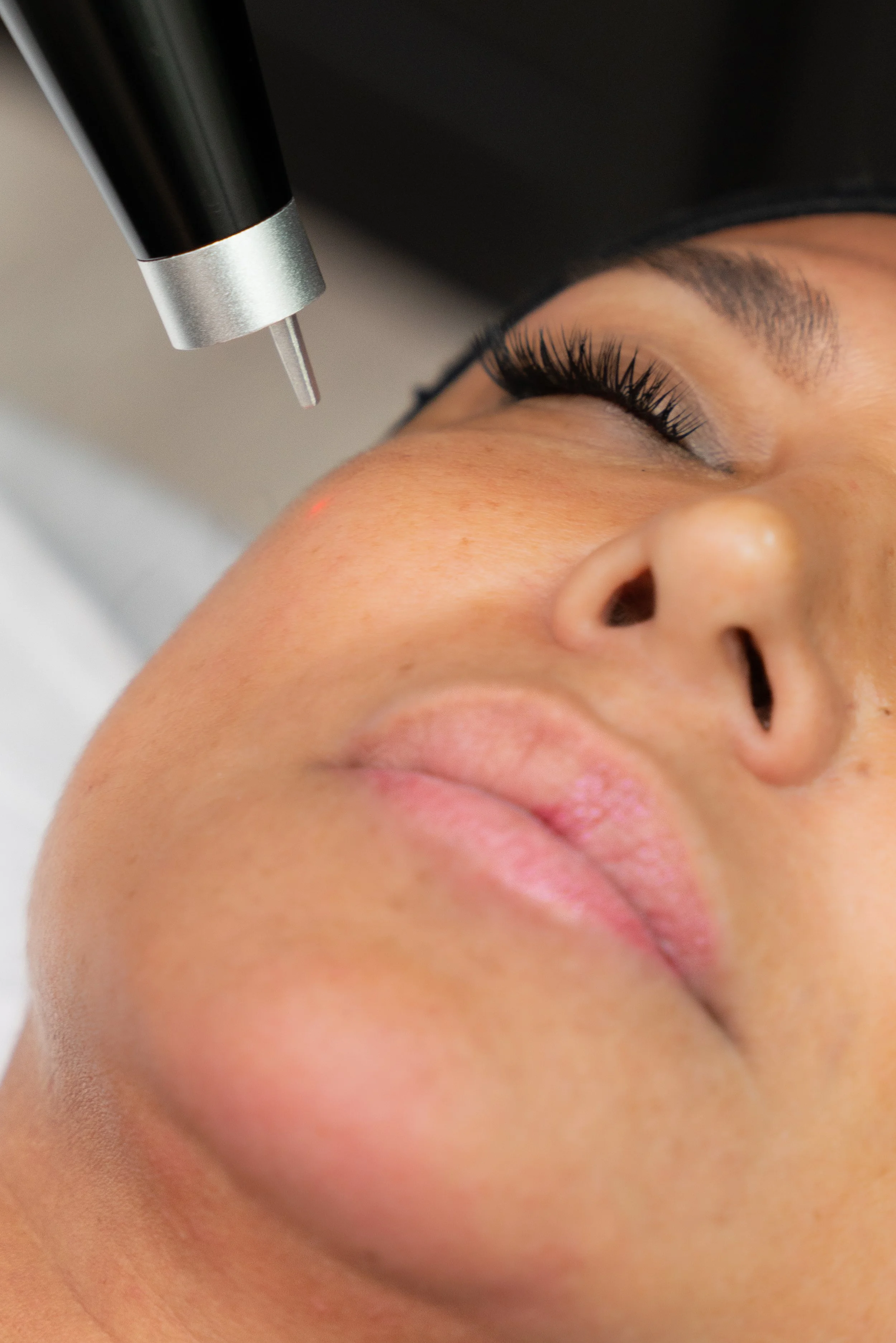 A woman lying down with her eyes closed, receiving a pico laser treatment on her face.