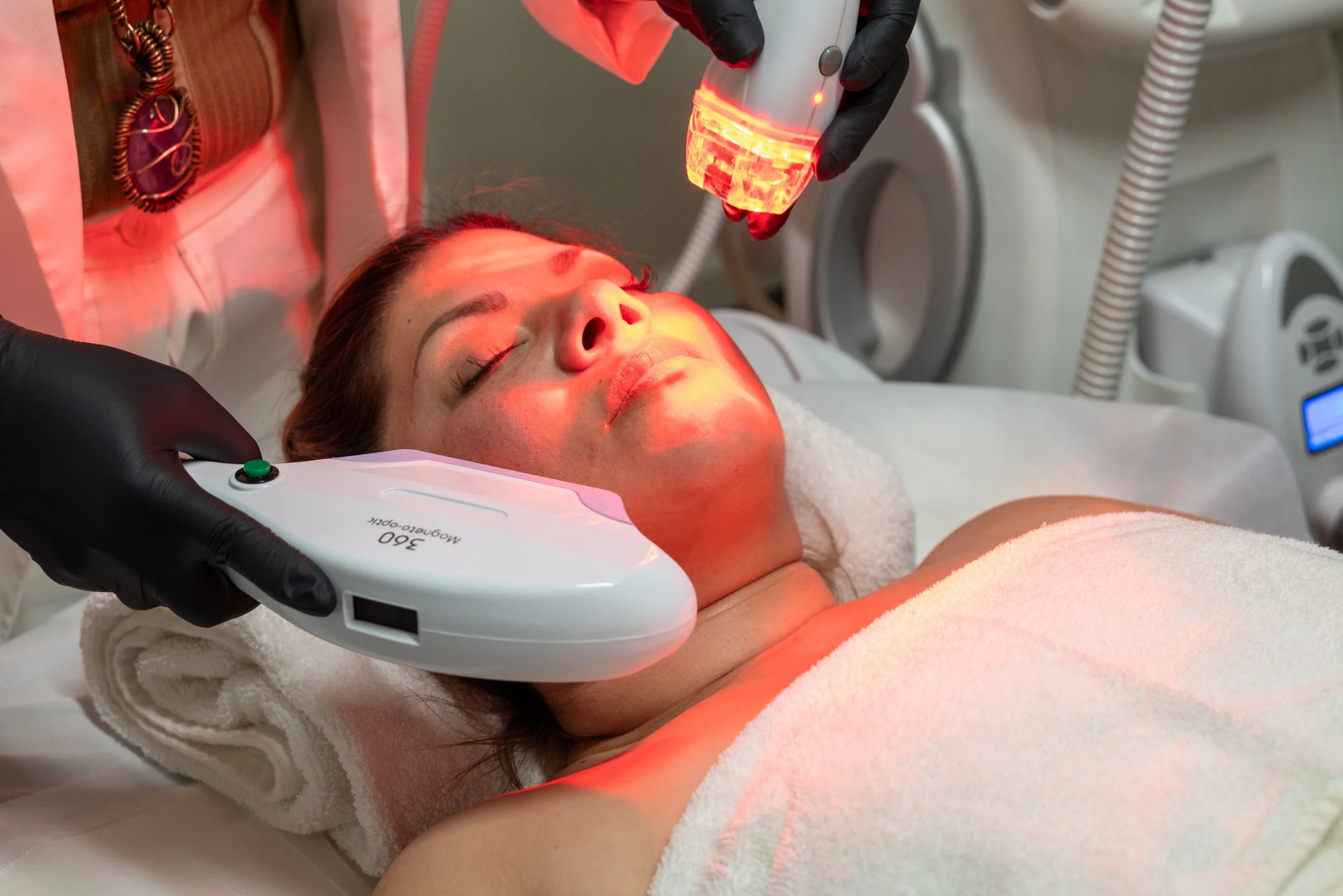Client receiving IPL and Velashape treatments on her face, with both handpieces positioned on the area and red light from the Velashape visible on the face.