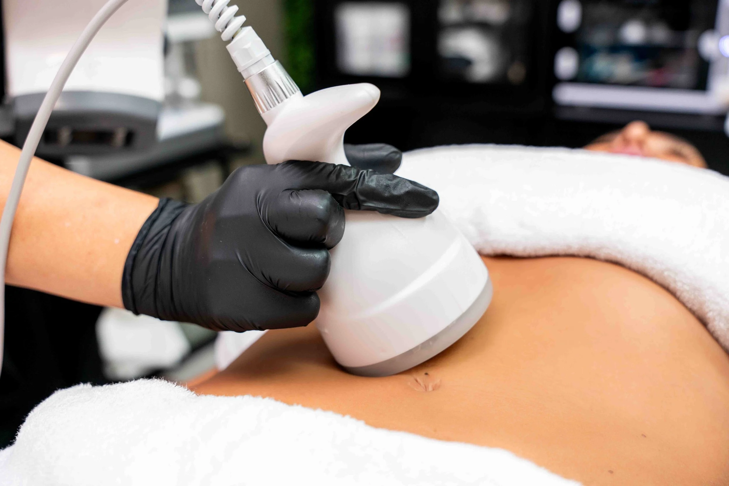 A person in black gloves performs an 80k cavitation treatment on a woman's abdomen in wakashe spa.