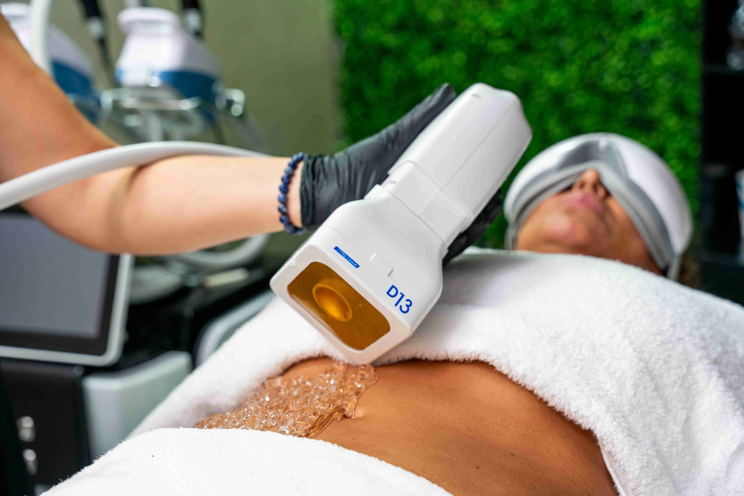 Client lying on a treatment bed receiving LipoFat HIFU on the abdomen, with a technician using a white handpiece while the client wears eye massage glasses.