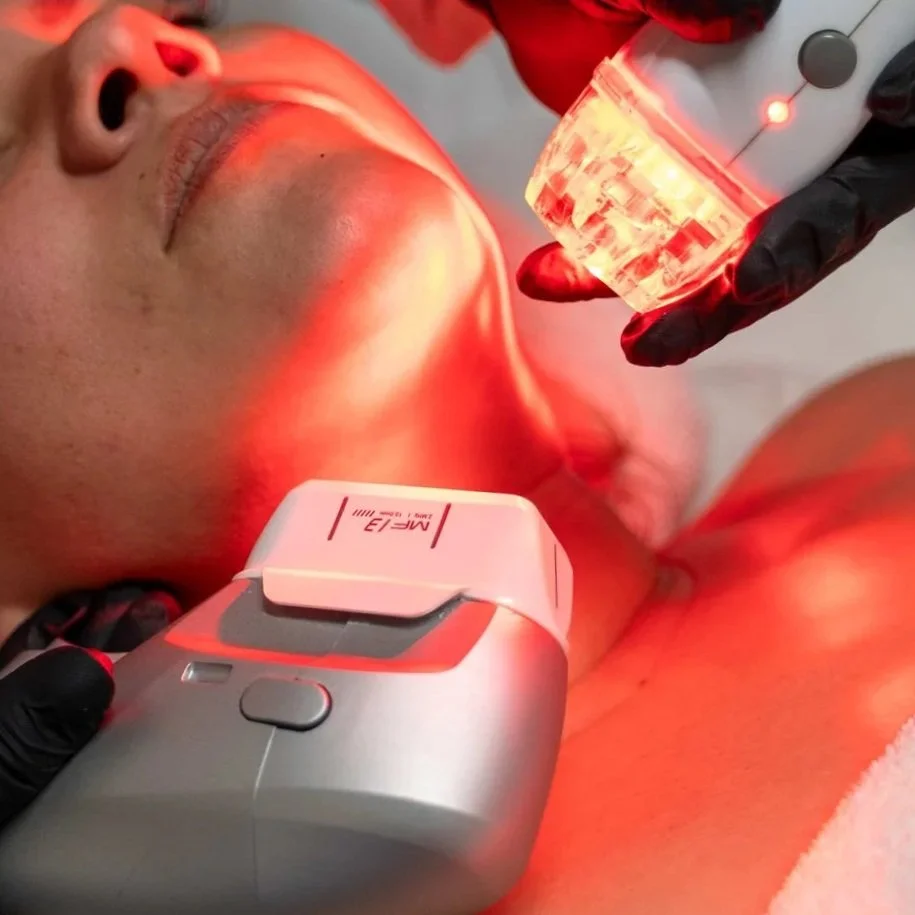 Client receiving 12D HIFU and Velashape treatments on the double chin, with both handpieces positioned on the area and red light from the Velashape visible on the face.