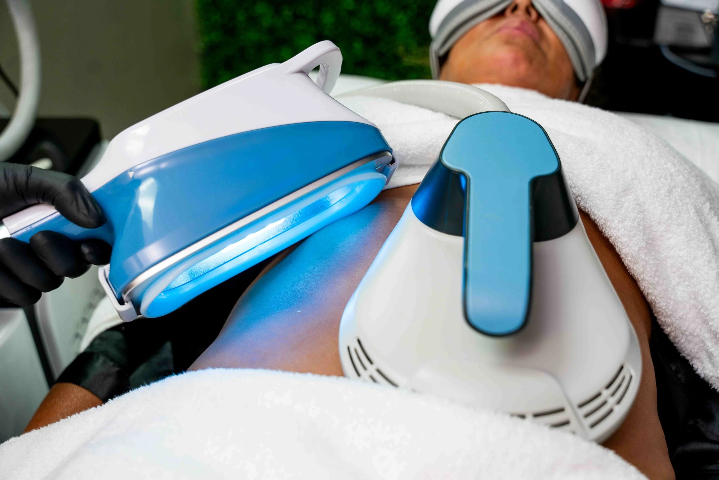 Client receiving Cryolipo 360 and Emsculpt treatment on the abdomen, wearing eye massage glasses while a technician operates the device with black gloves.