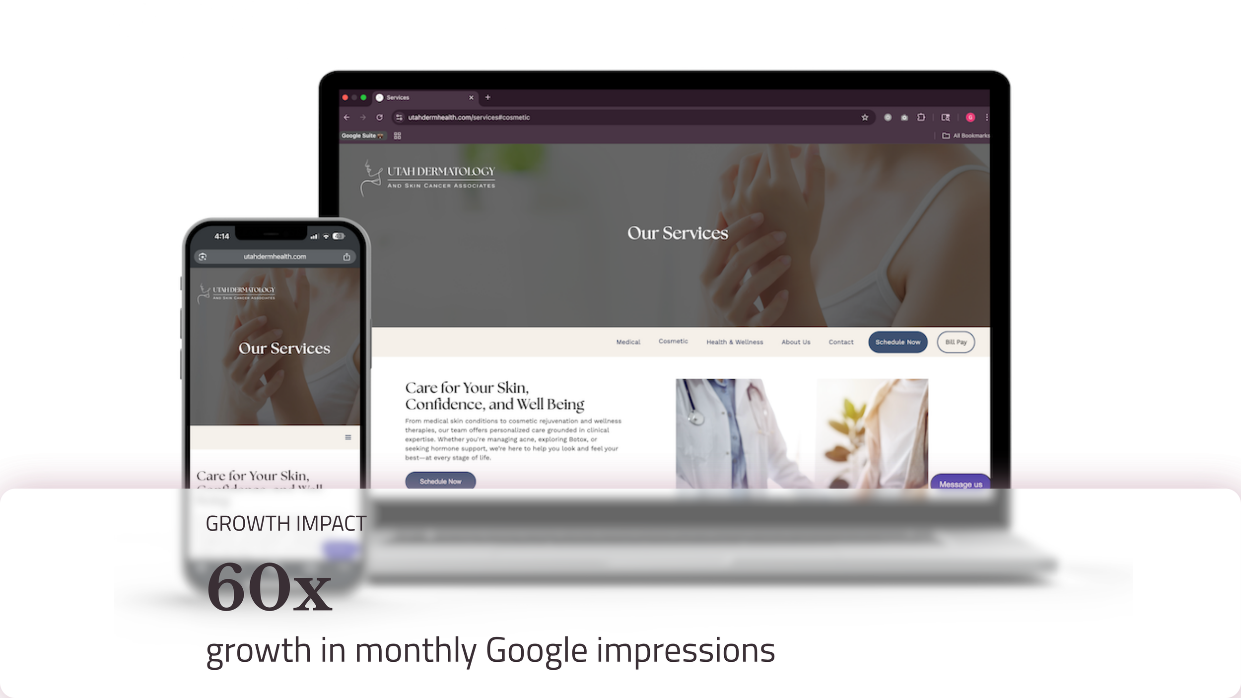 A phone and laptop mock up of the website for Utah Dermatology and Skin Cancer Associates, with the words: "Growth Impact: 60x Growth in monthly google impressions"